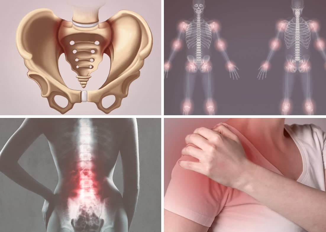 Imagem ilustrativa sobre Espondiloartrites na reumatologia